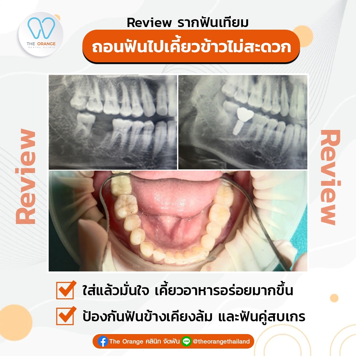 Home The Orange Dental Clinic